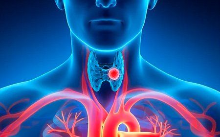 Пораженная щитовидная железа